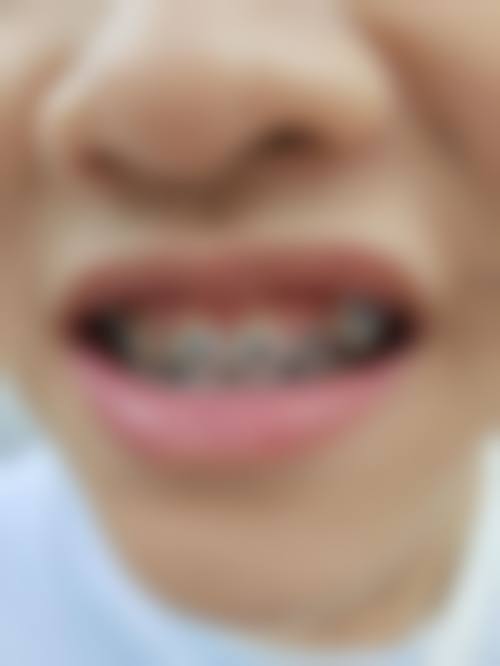 张家界医雅口腔的患者口碑与真实评价