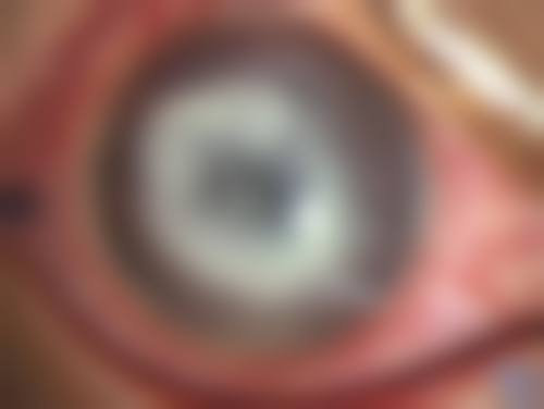重庆市急救医疗中 心眼科擅长项目。