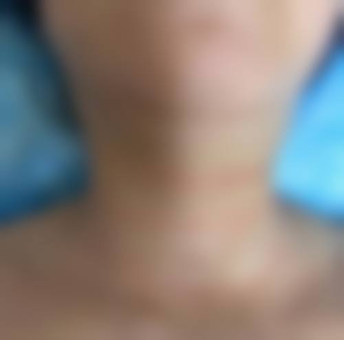 西安碑林栾术医疗美容诊所治疗反馈与口碑评价。