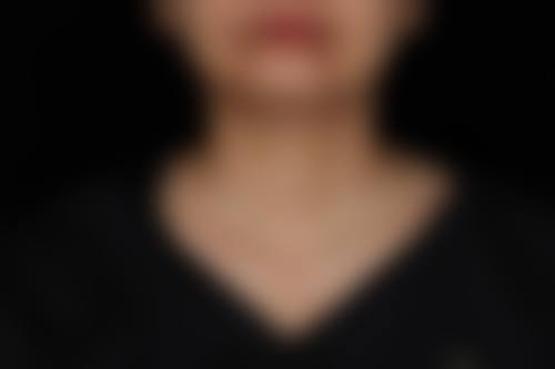 西安碑林栾术医疗美容诊所医生团队经验稳定。