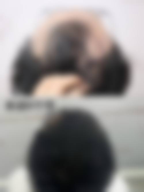 预约优惠活动