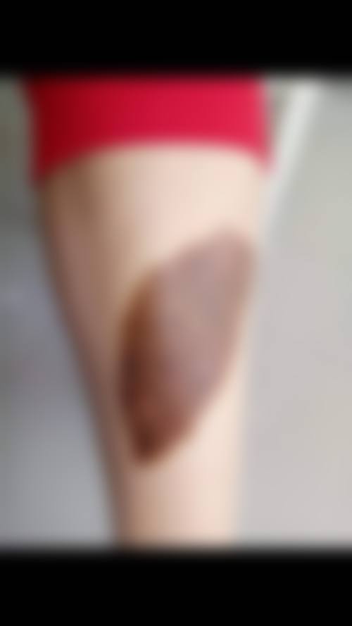 延吉倾嫣整形医院治疗反馈与口碑评价。