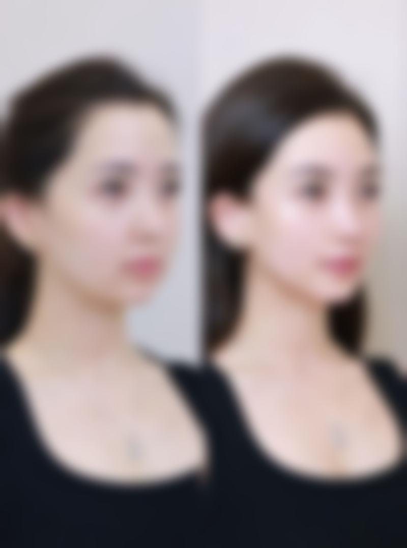 延吉阿信整形美容诊所怎么样?正规资质让您安心