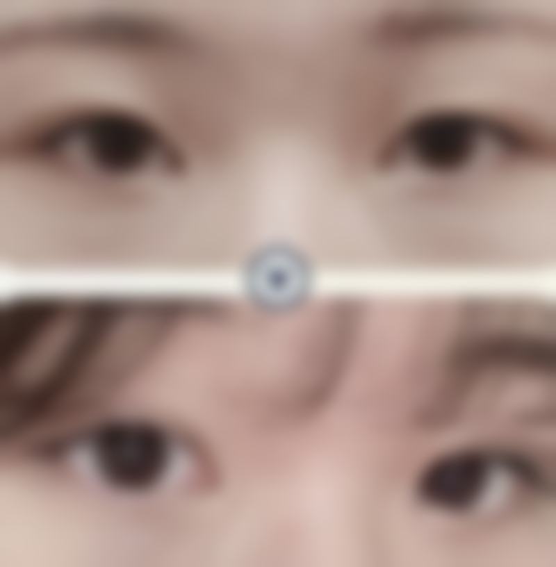 延吉阿信整形美容诊所预约挂号方式——便捷效率高,轻松就诊