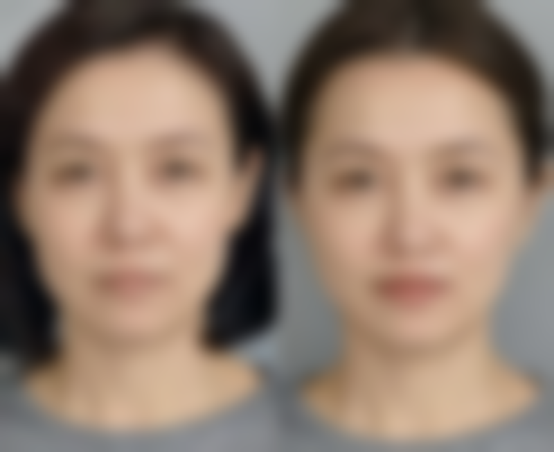 哈尔滨诺依美医疗美容门诊部擅长哪些项目?核心领域全览