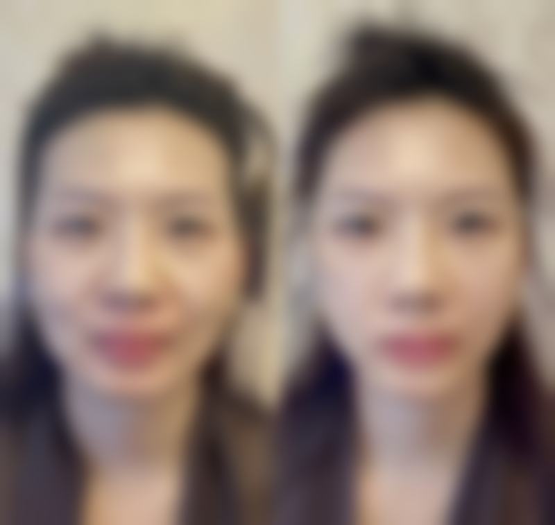 秦明灿医生的技术实力